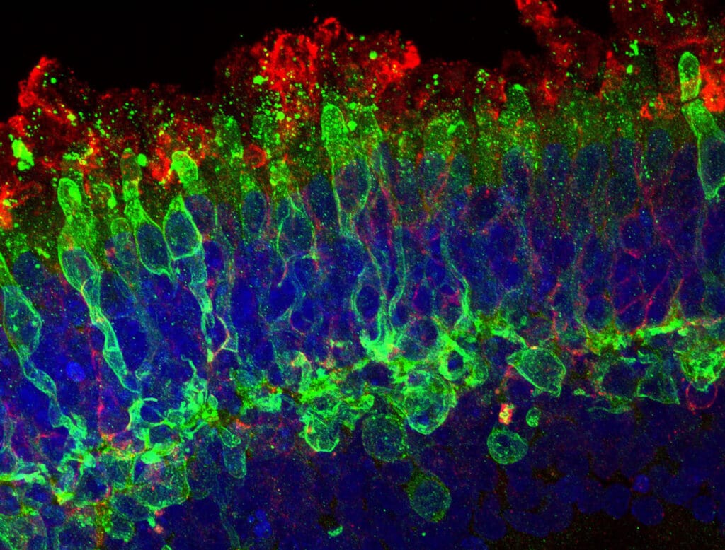 Inherited retinal diseases – the patient journey - Insight