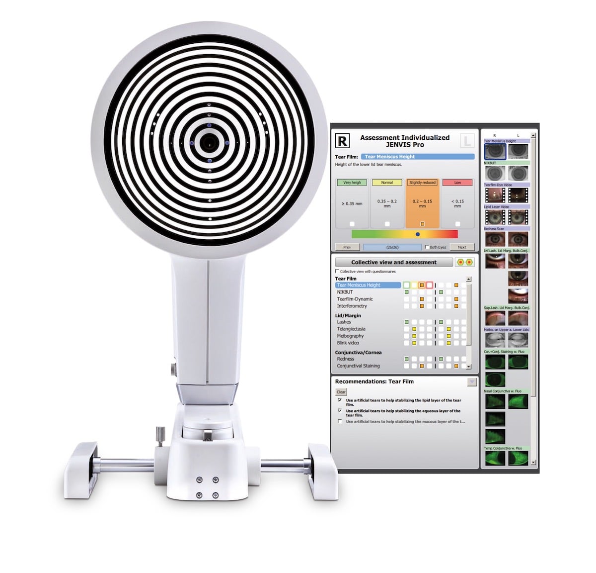 Jenvis Report.pdf 2023 Dry Eye Product Showcase - Insight