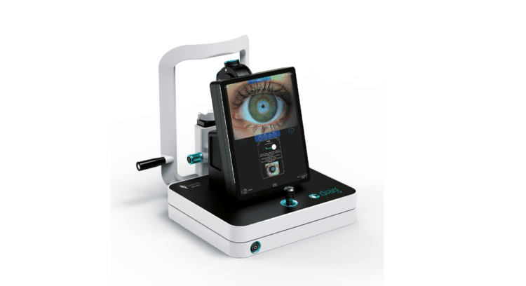 The device incorporates AI based on algorithms derived from more than one million clinically validated images. Image: Lumibird.