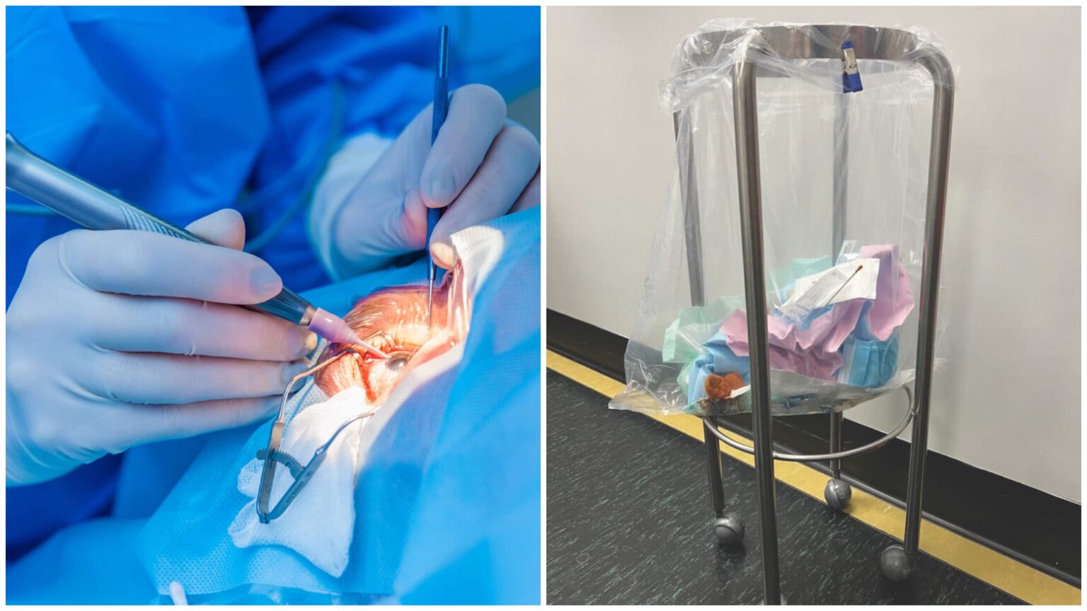 Single-use vs. reusables: Cataract surgery study finds 27 times greater ...
