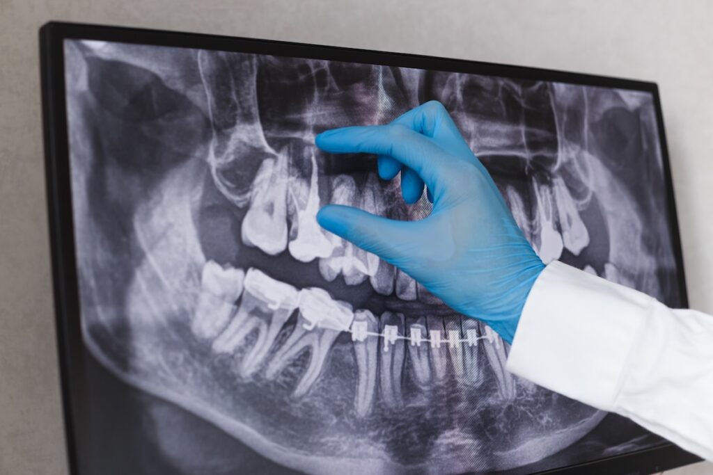 Man's own tooth implanted in eye to restore his vision - Insight
