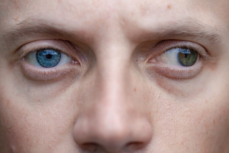 The device beeps when it senses that the eye is drifting. Image: Vladimir Zlotnik/stock.adobe.com.