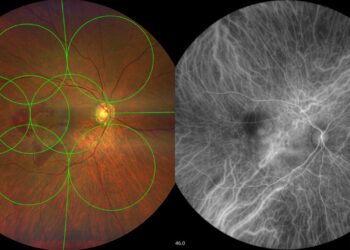 The CLARUS 700 can capture widefield, early-phase high-resolution images, including simultaneous FA and ICGA. Image: ZEISS