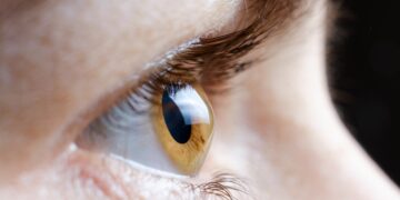This CPD item guides optometrists in practical care of keratoconus. Image: Zarina Lukash/stock.adobe.com.